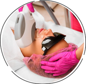 Freckle removal laser treatment