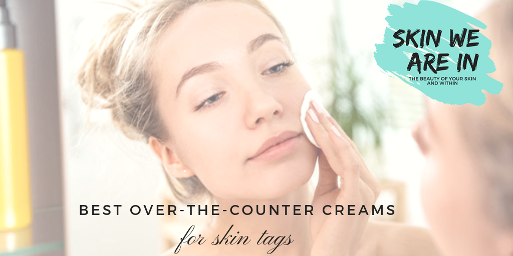 Over the Counter Skin Tag Removal Cream