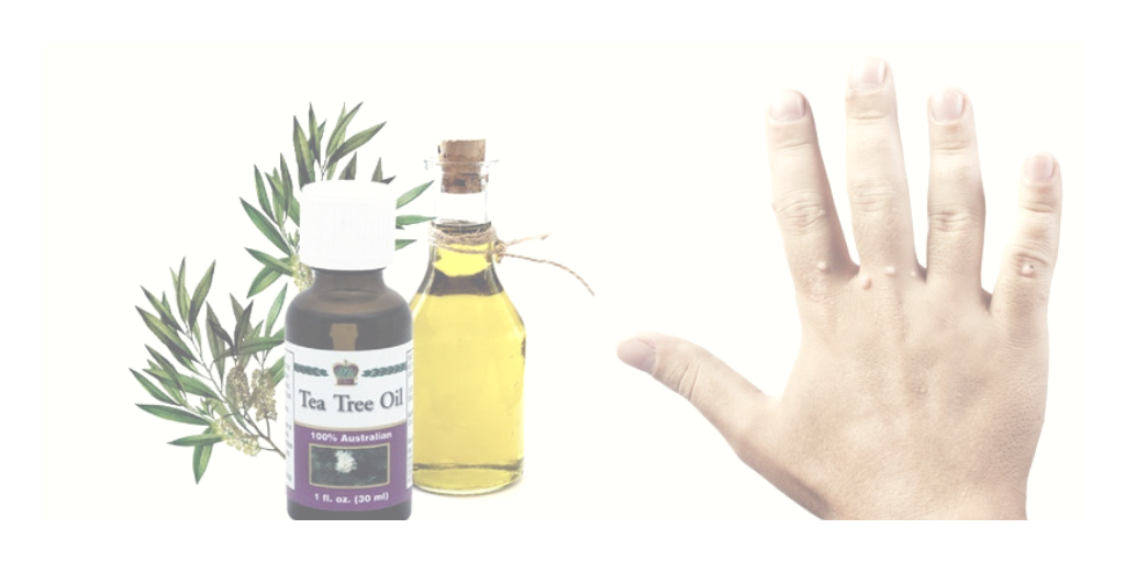 Teav Tree Oil for Skin Tags